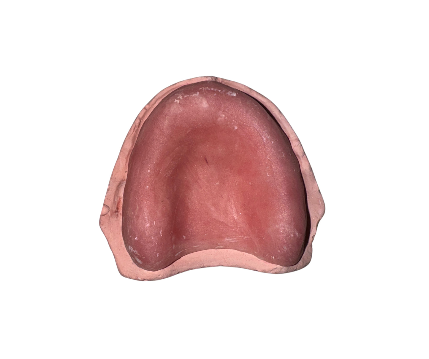 Cast with denture base