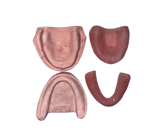 Cast with denture base