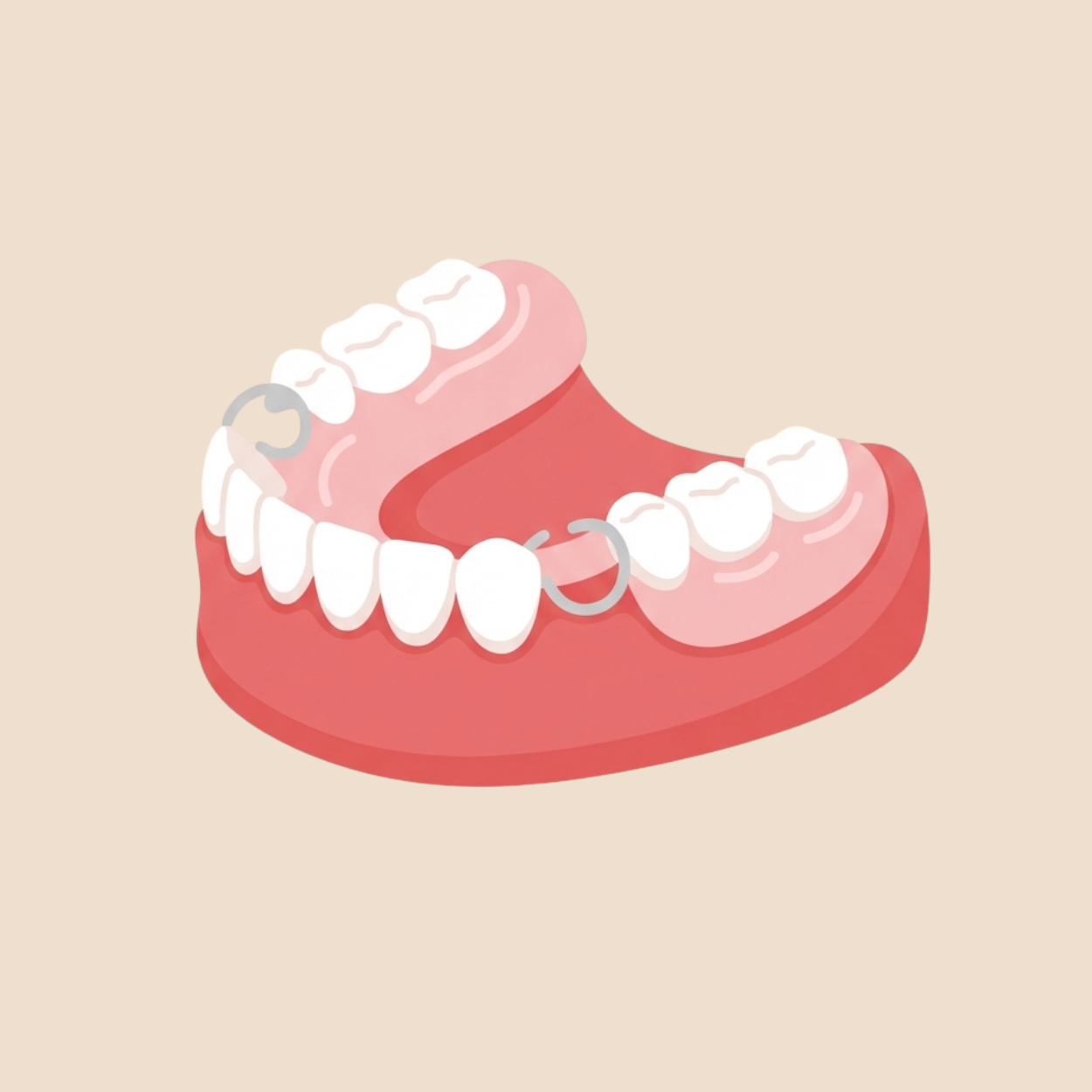 Removable Prosthodontics